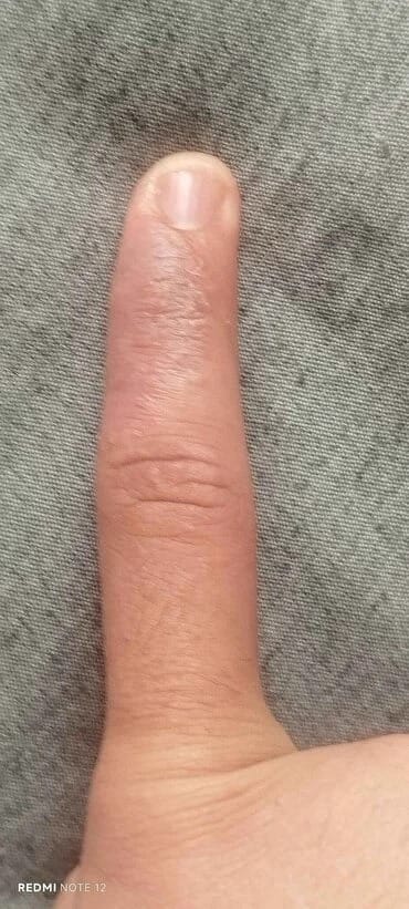Customer photo review of RBY Botanik Cilt Balmı Yatıştırıcı Bakım Kremi 50 ml