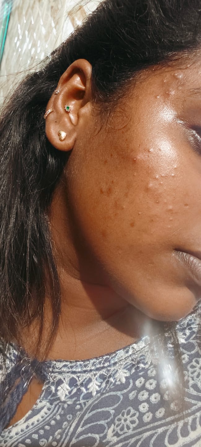 Customer photo review of Turmeric Night Repair Cream