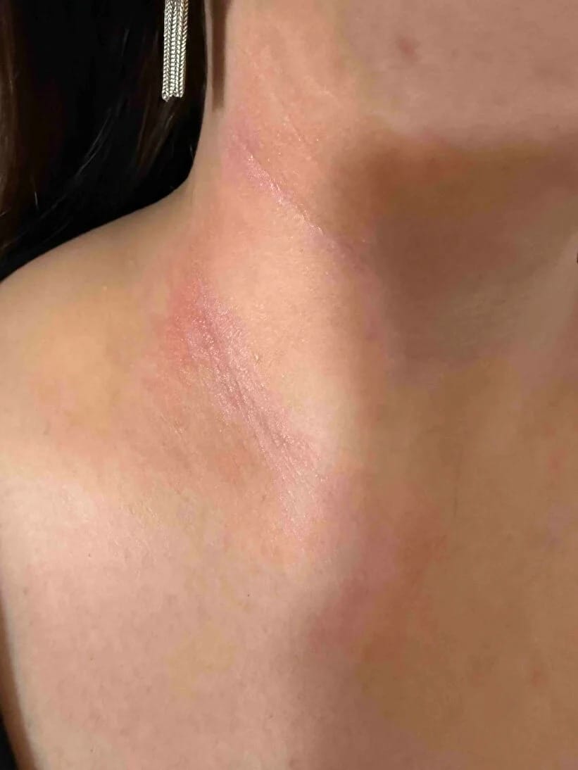 Customer photo review of RBY Botanik Cilt Balmı Yatıştırıcı Bakım Kremi 50 ml