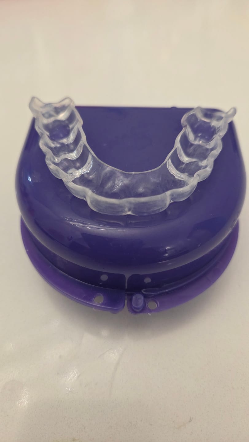 Customer photo review of Hard Night Guard