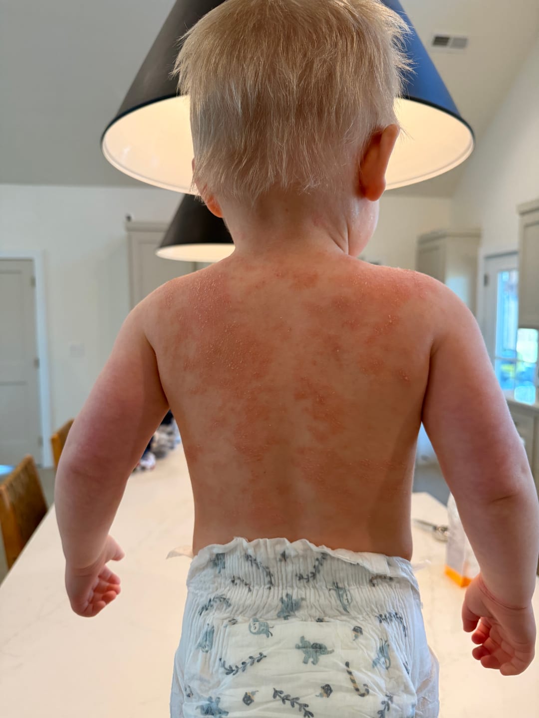 Customer photo review of Children’s Gut Rebalance Kit