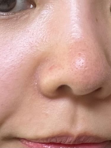 Customer photo review of eple:me HYDRA CELL BOOSTING TONER