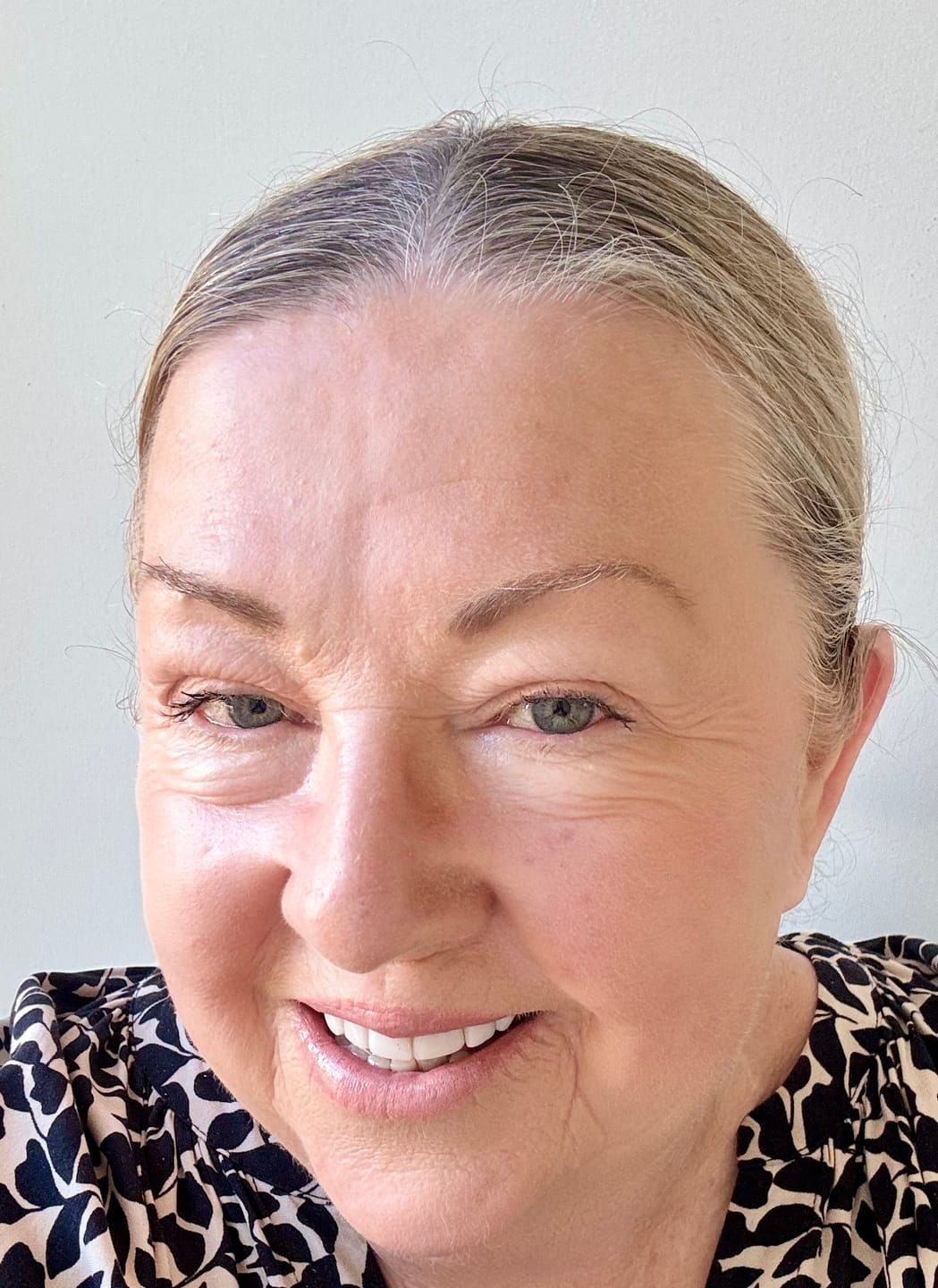 Customer photo review of drNC CONCENTRATED CC+ CREAM SPF30