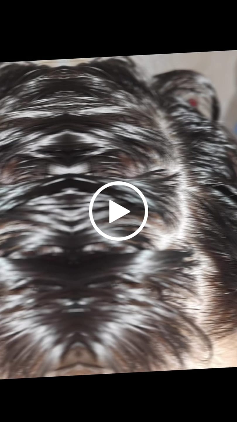 Customer video review of Sebovia Essence Seborrhea Dermatitis Sampon érzékeny bőrre