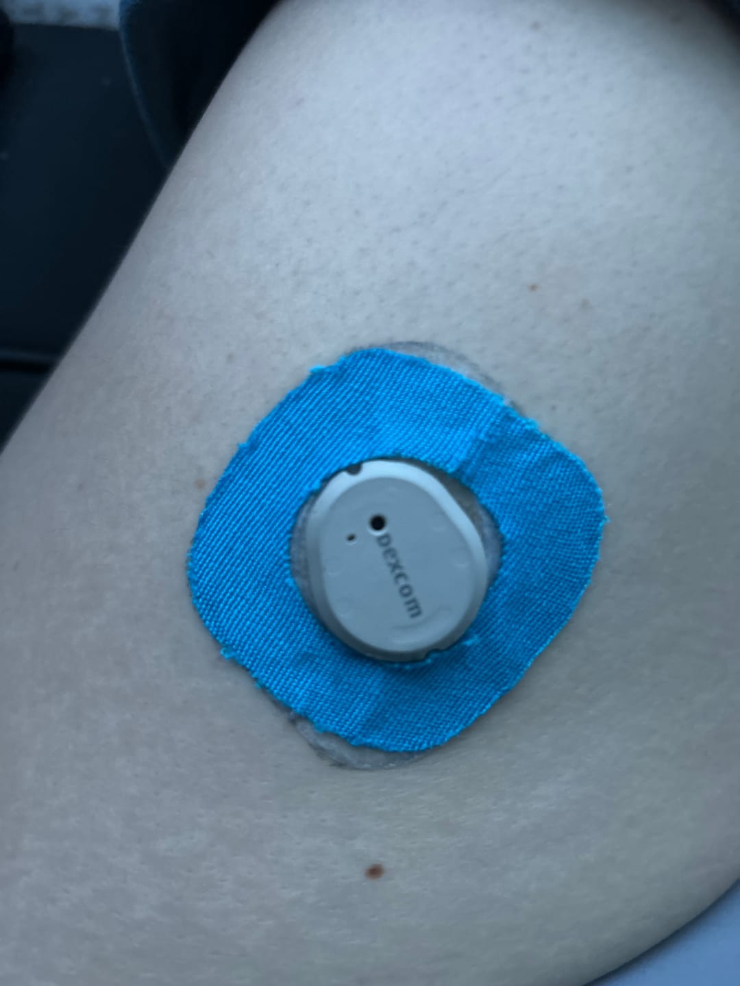 Customer photo review of Skin Grip Original - Dexcom G7 & Stelo Adhesive Patches (With Cutout)