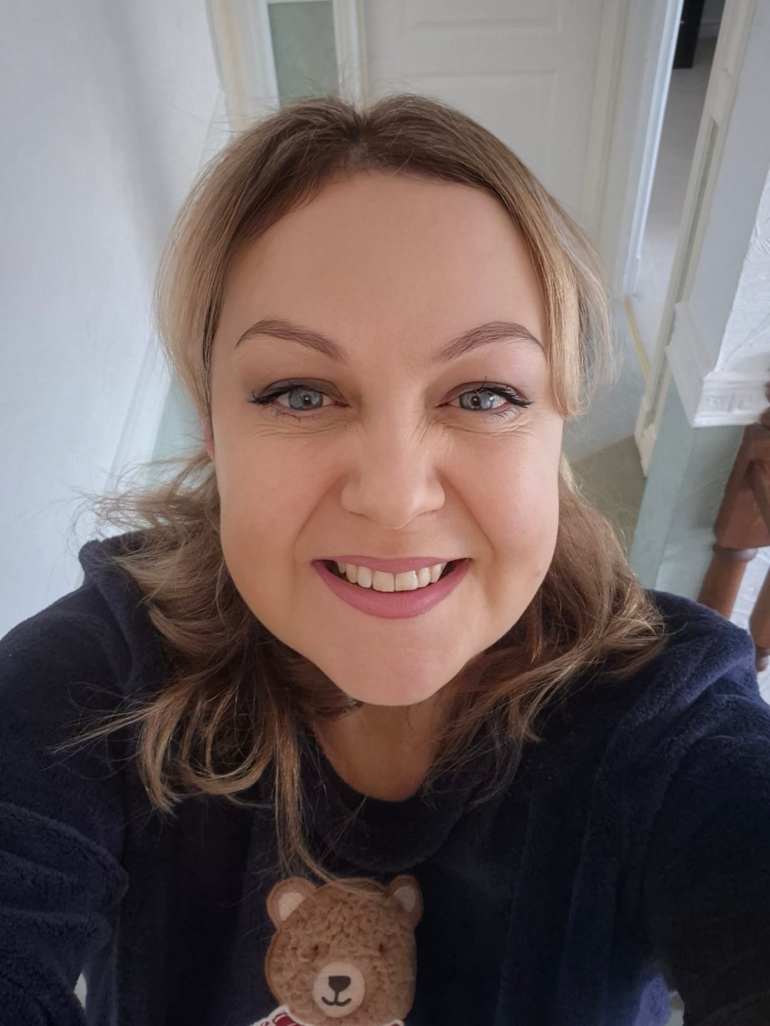 Customer photo review of Hyaluronic Acid Serum 30ml