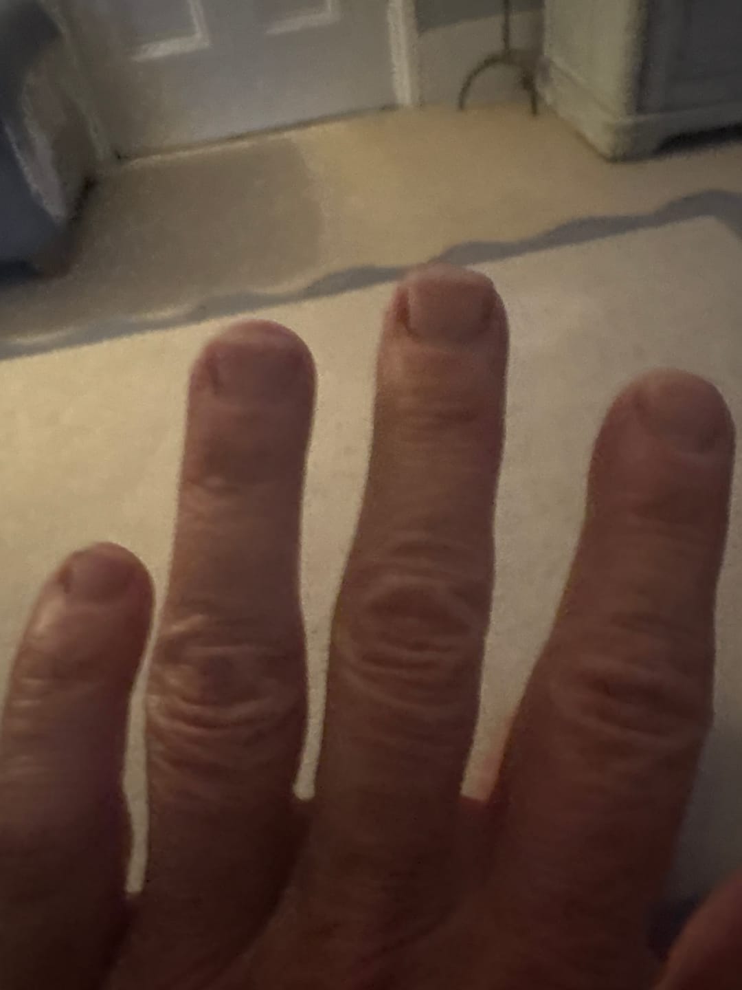 Customer photo review of 30-Day Hand Recovery System