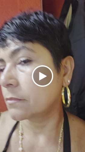 Customer video review of 2 Month Supply of Seranova Microneedling Infusion System™