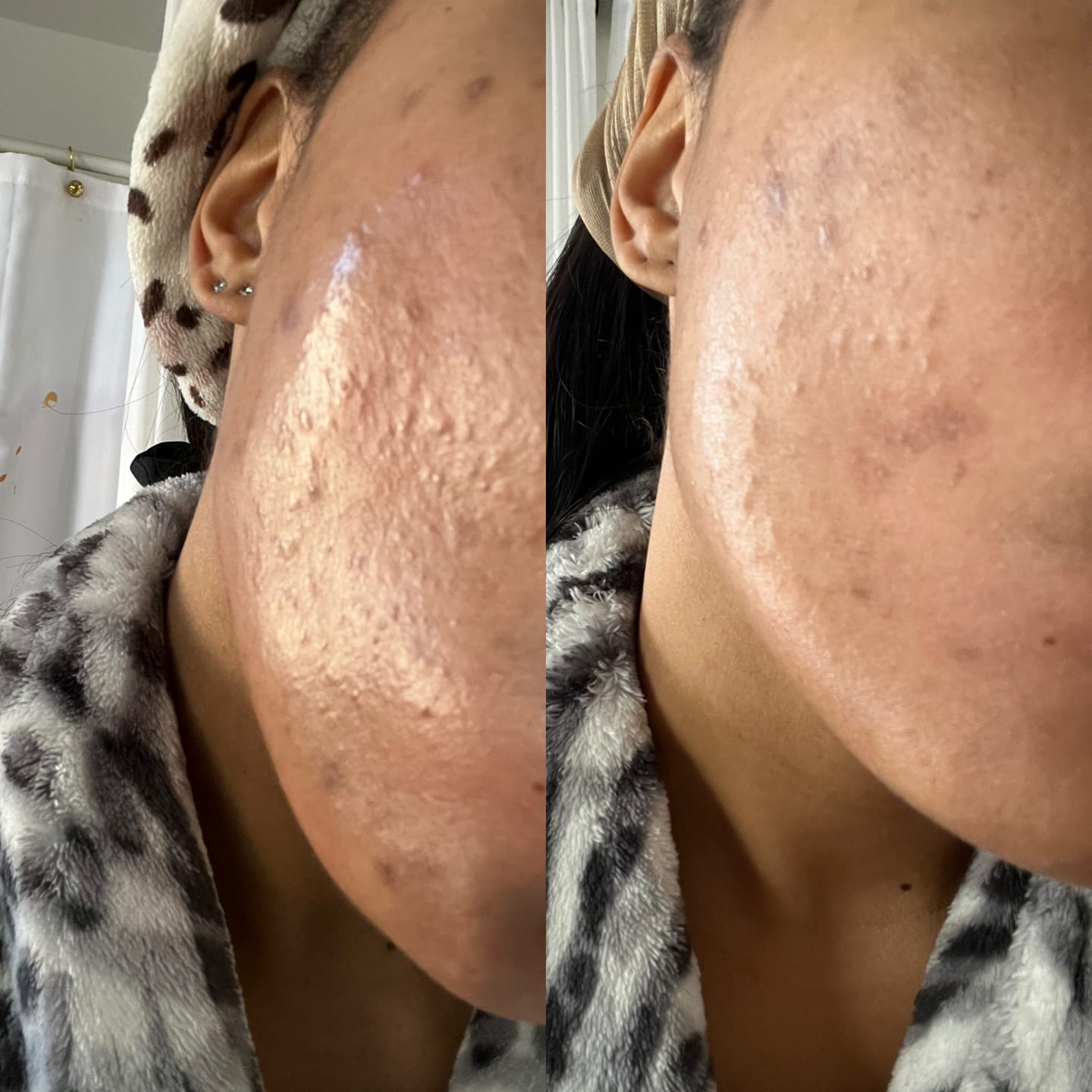 Customer photo review of RETINOL INTENSE SERUM (NEW)