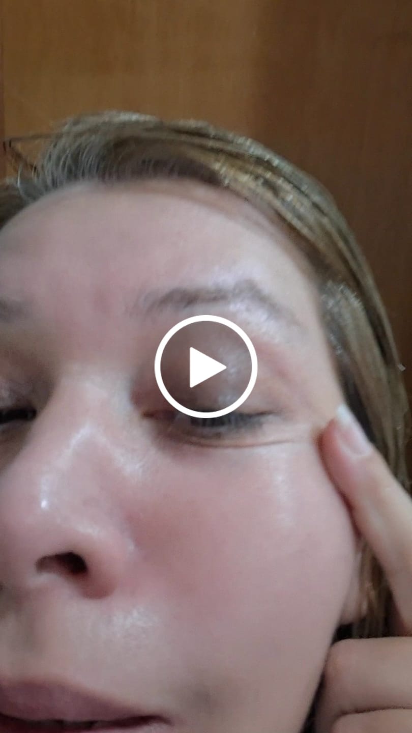 Customer video review of Solução Exossomos + PDRN + Peptídeos