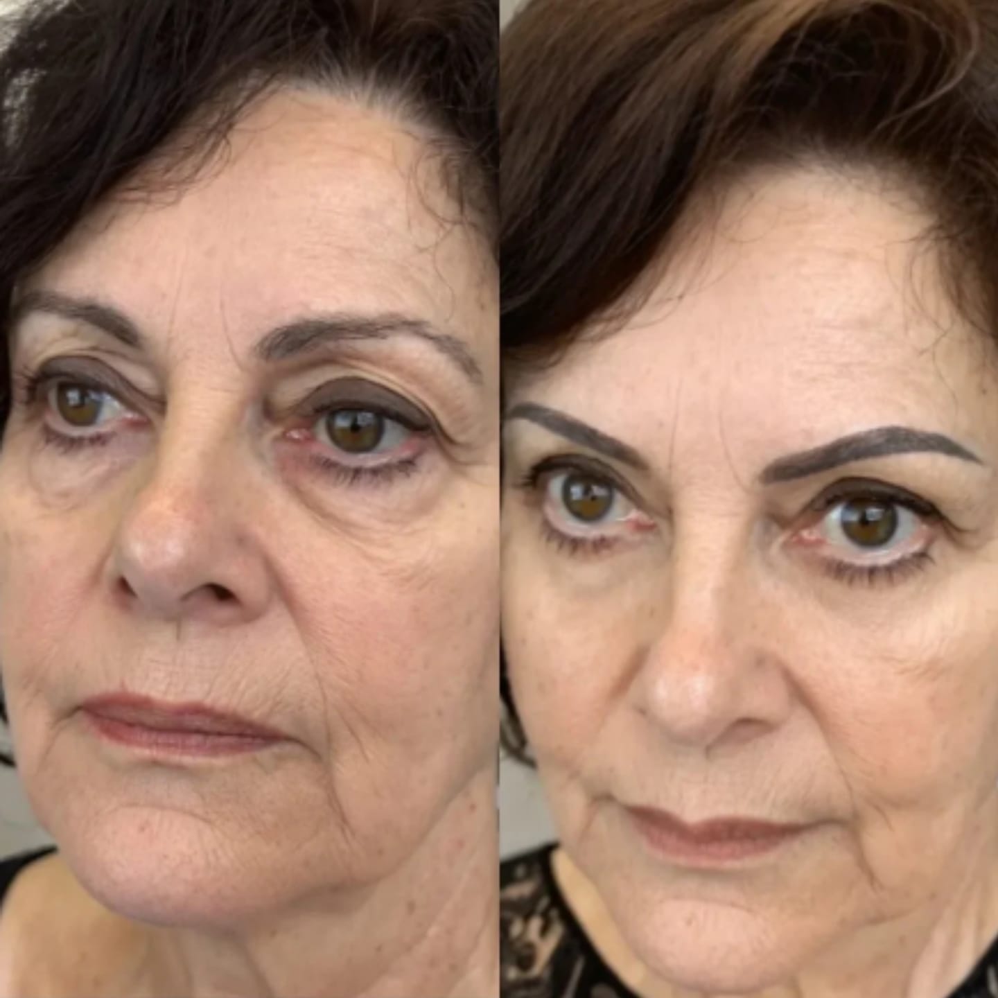 Customer photo review of LUMIN EYE™ Rotlicht & EMS Brille
