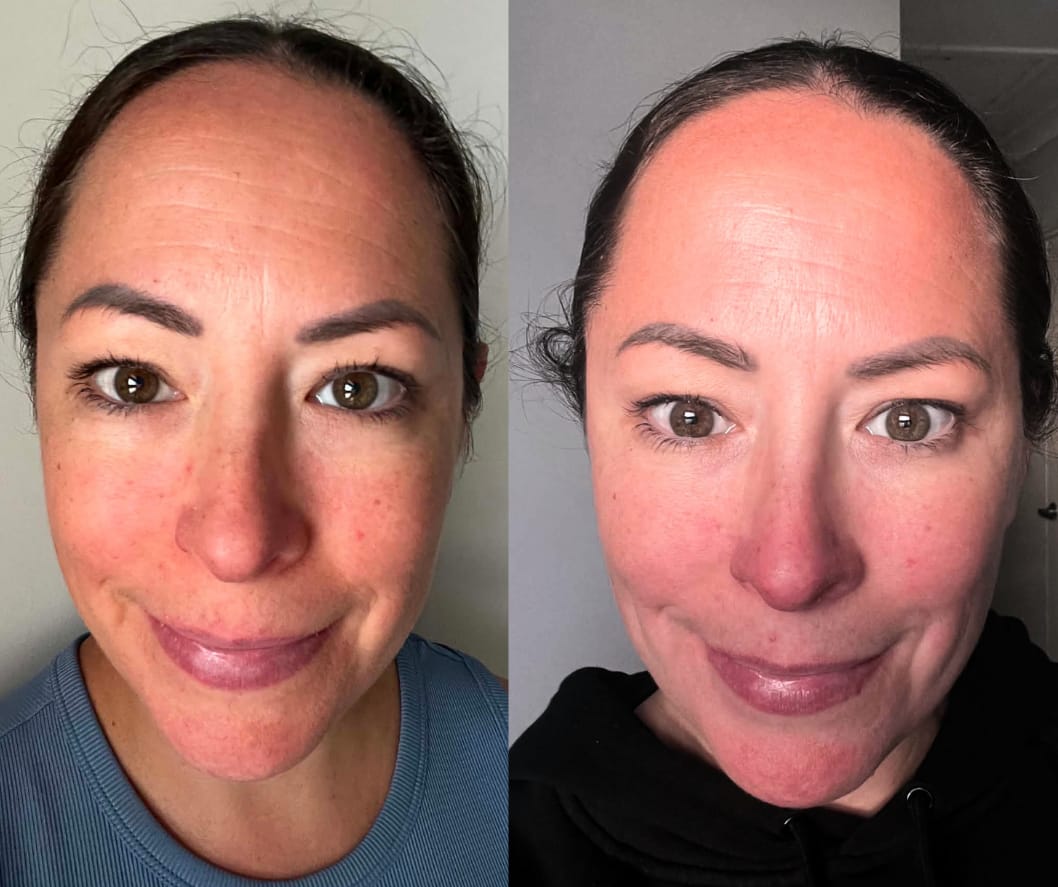 Customer photo review of LED Face Mask