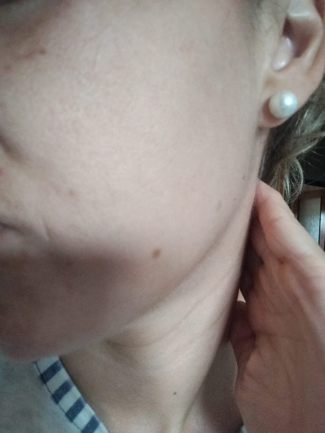 Customer photo review of POWER H Hidratante c/ Hialurónico, Ceramidas & Niacinamida