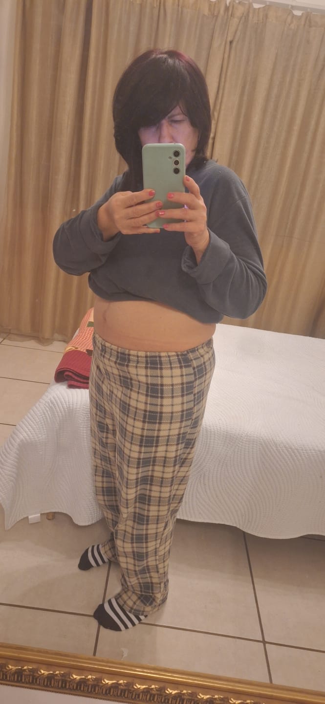 Customer photo review of CheetaThin® Weight Management - Buy 2 Get 2 Free, Free Access to Exit Plan + Win R5,000 Challenge