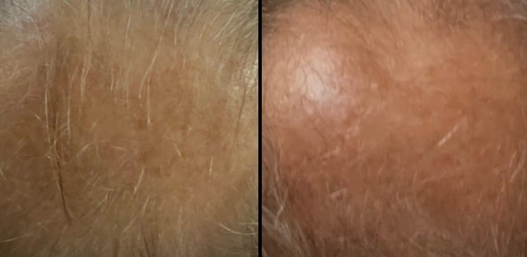 Customer photo review of SHAMPOING NATUREL AU ROMARIN ET À LA KÉRATINE — POUR DES CHEVEUX PLUS ÉPAIS ET PLUS VOLUMINEUX