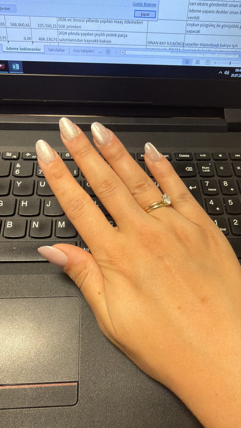 Customer photo review of Angel Touch - Short Oval - 30 Adet Takma Tırnak