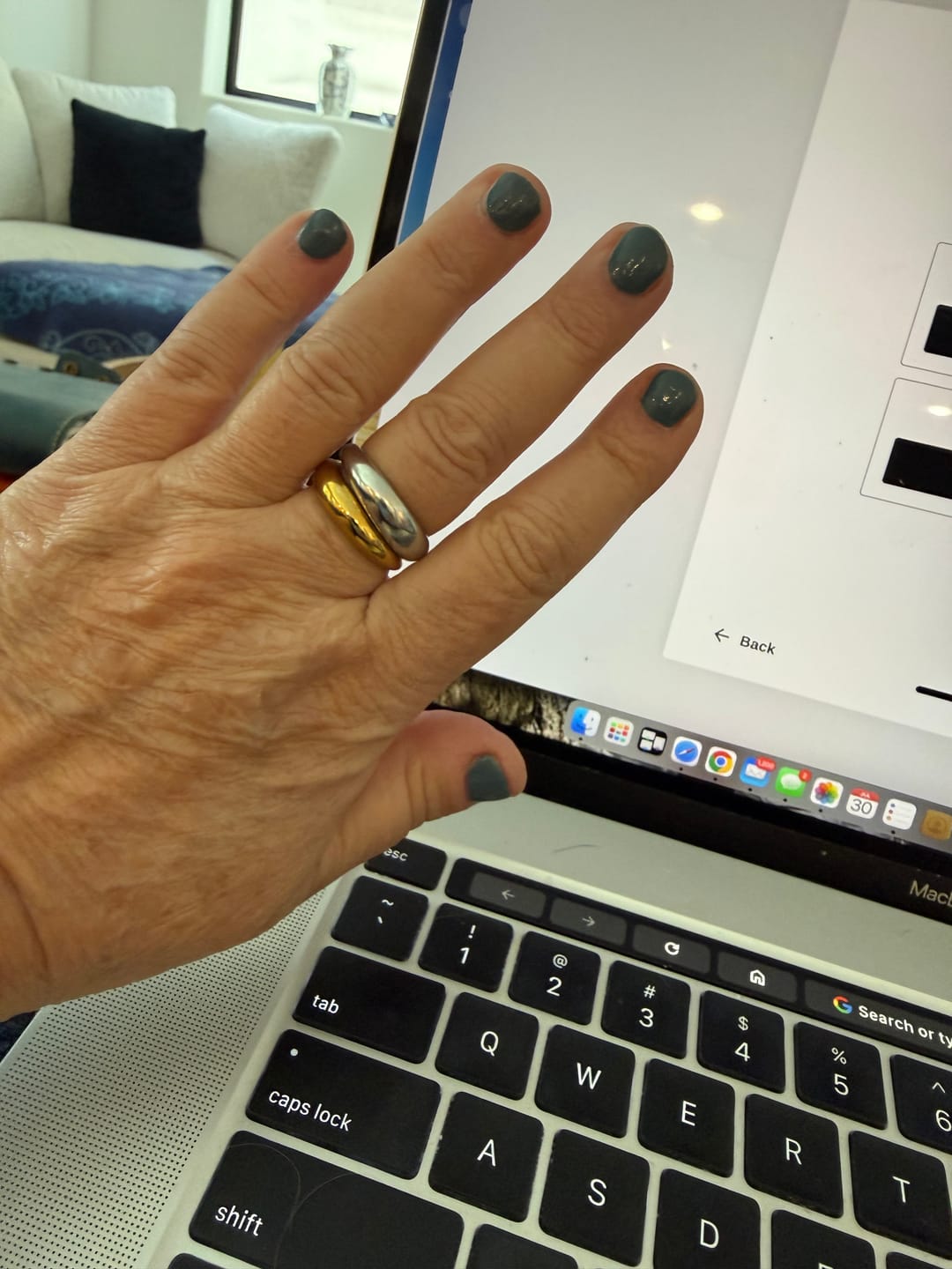 Customer photo review of Leilani Dome Ring (Bundle)