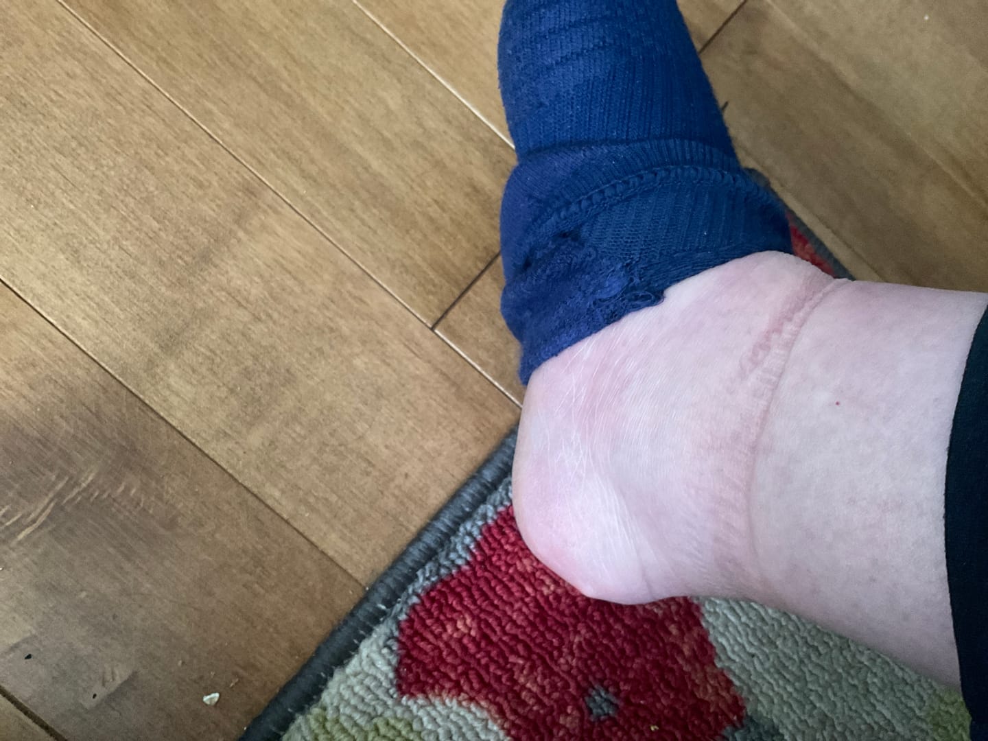 Customer photo review of Solid Essentials Ankle Compression Socks 5-Pack Bundle