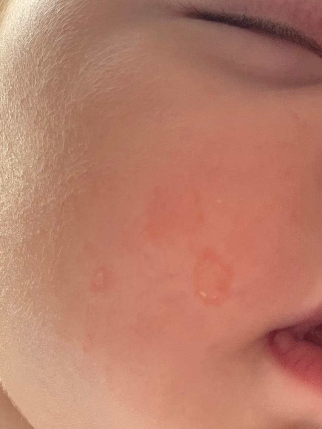 Customer photo review of Baby Cream