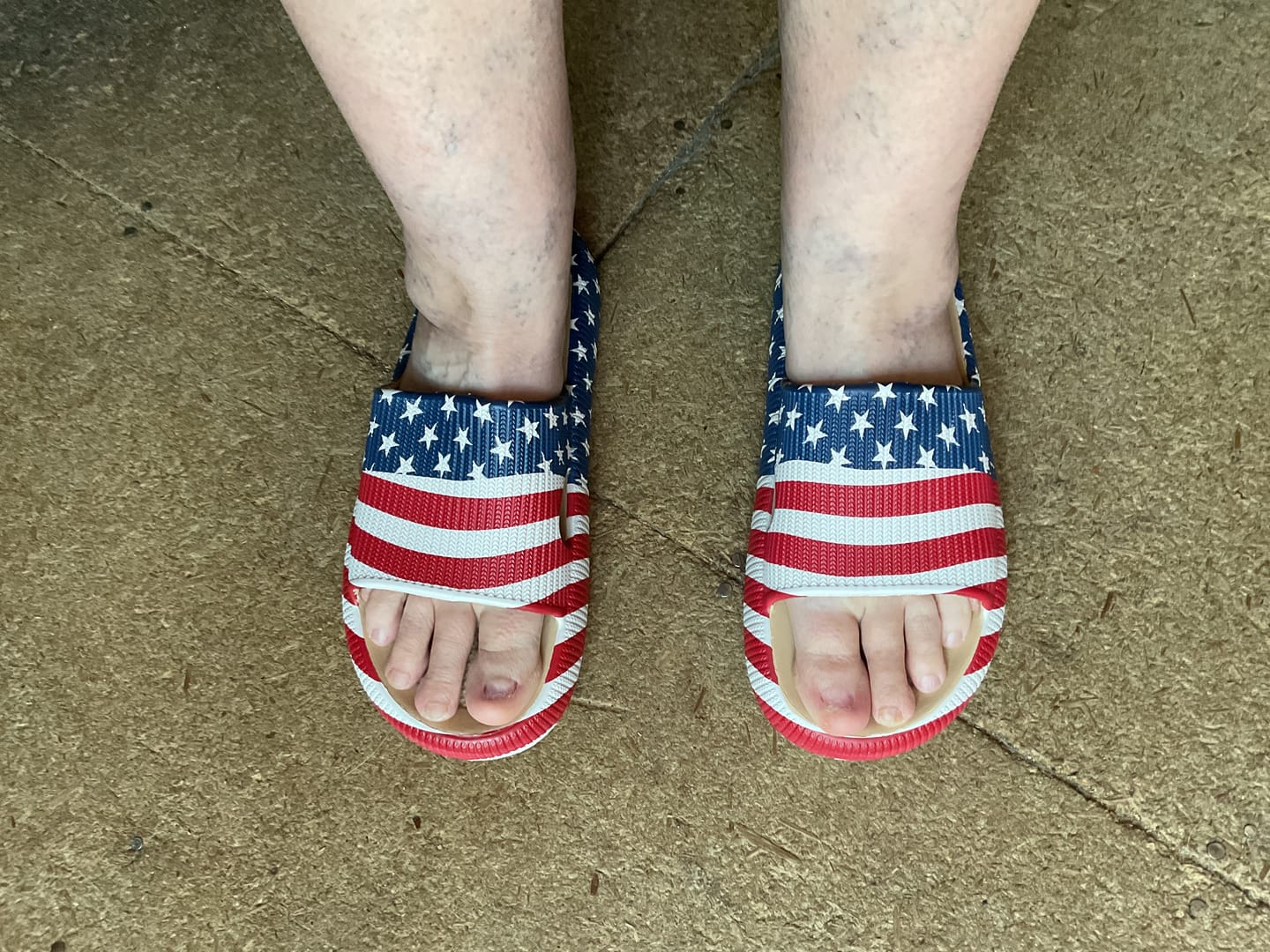 Customer photo review of Cloud Slides - Original Cushion Comfort
