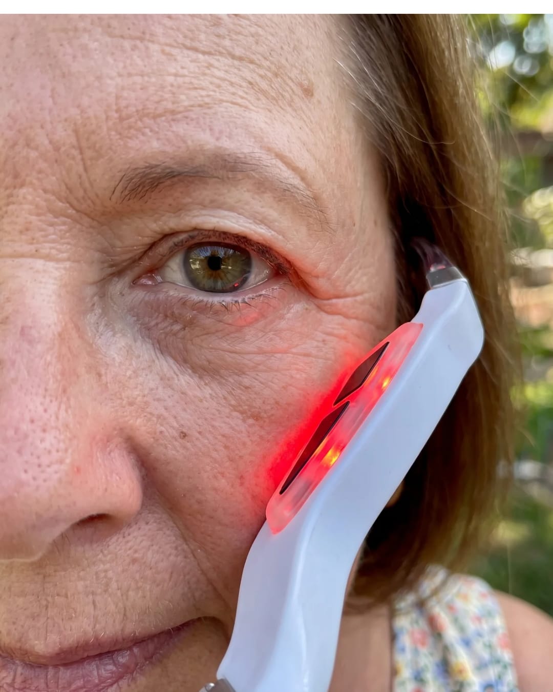 Customer photo review of LUMIN EYE™ Rotlicht & EMS Brille