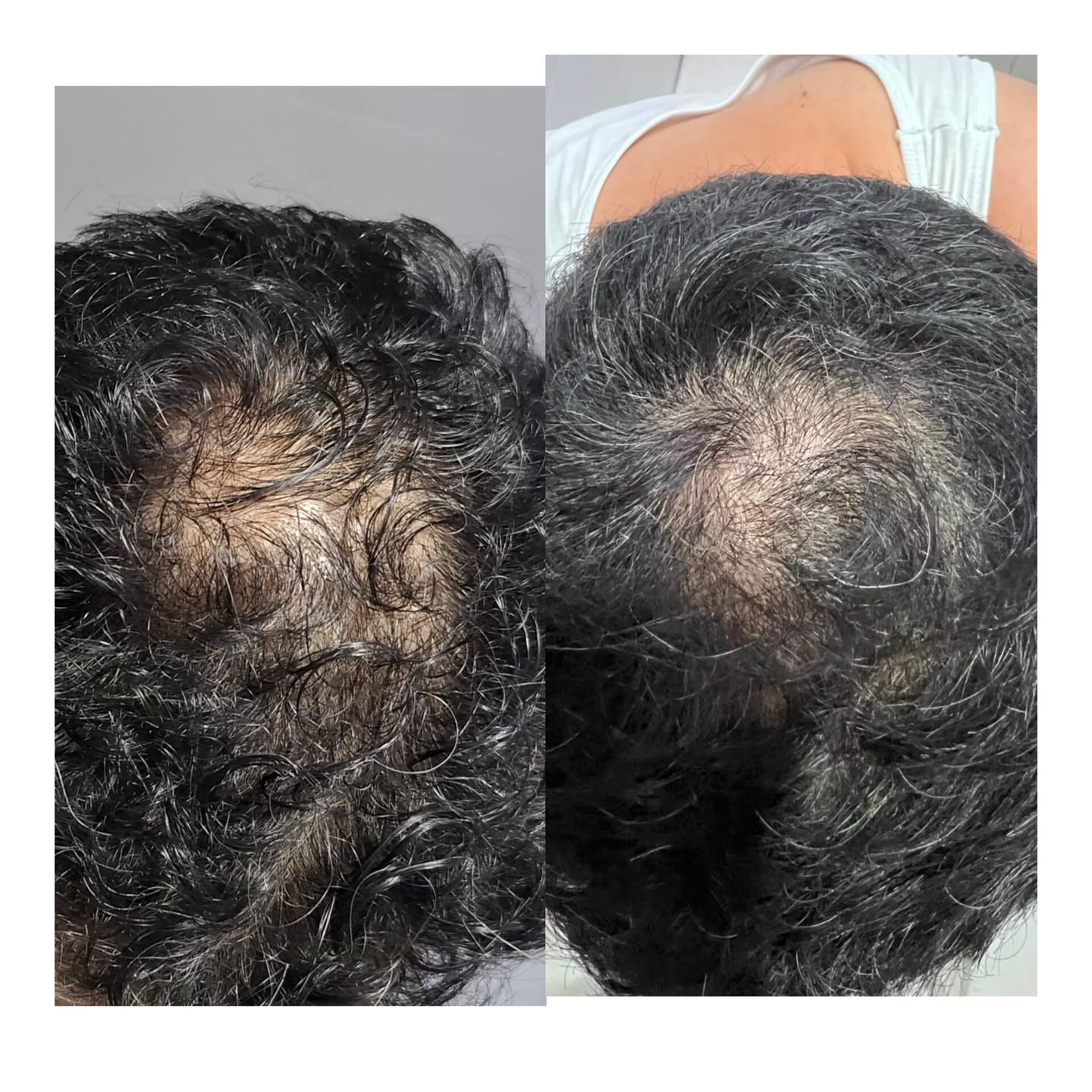 Customer photo review of KIT CAPILAR: Shampoo solido, Acondicionador Solido, Oleo Capilar y Tónico capilar