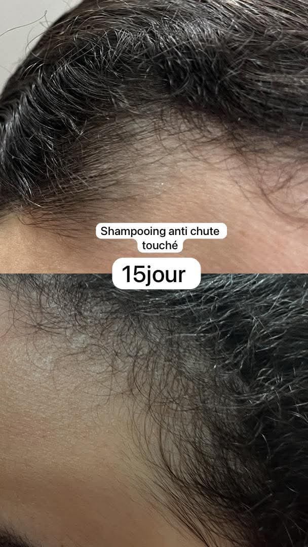 Customer photo review of Pack Anti Chute Touché