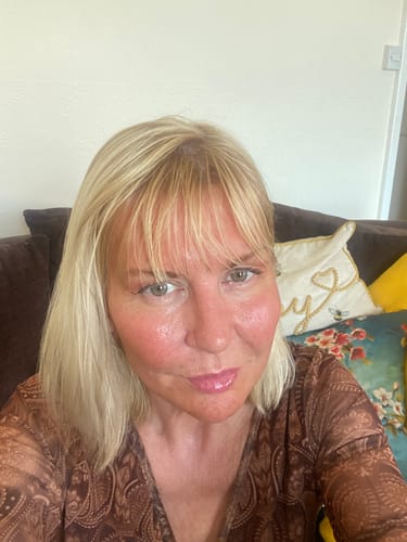 Reviewer showing smooth and plump skin after using the Seranova Micro Infusion System.