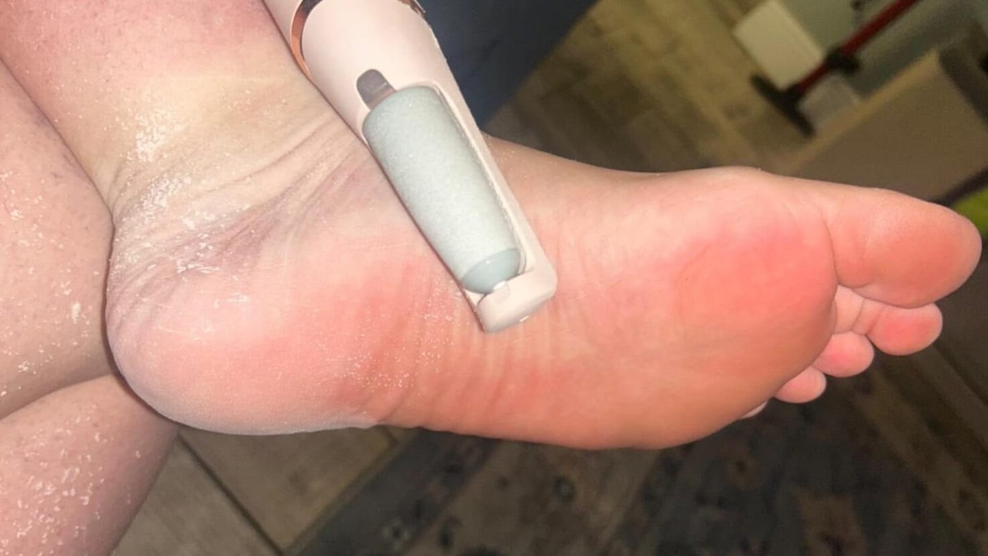 Customer photo review of Valanea SilkSmooth Pro™ Electric Foot Callus Remover