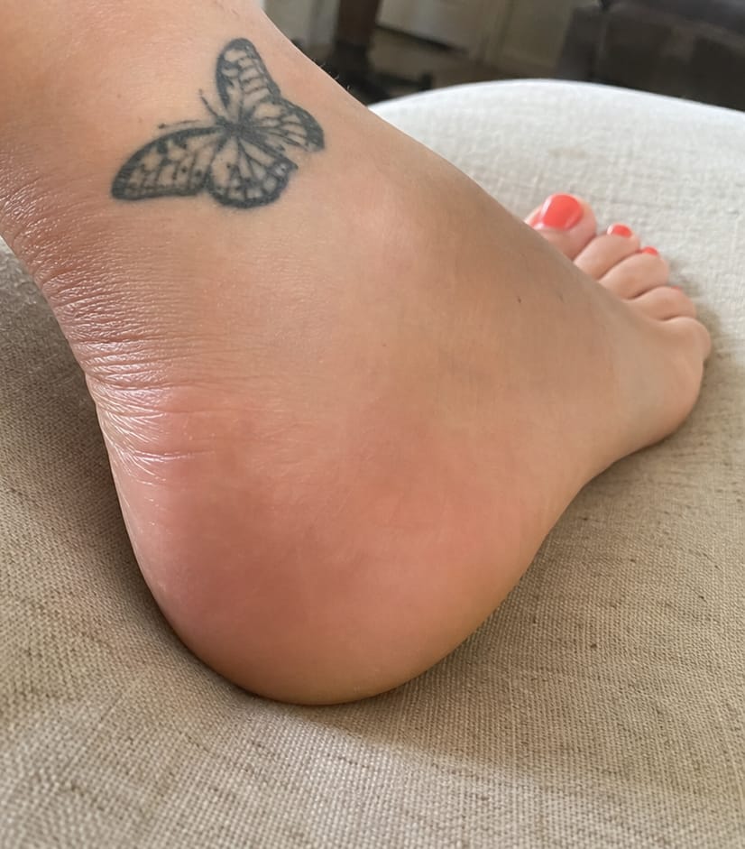 Customer photo review of Valanea SilkSmooth Pro™ Electric Foot Callus Remover