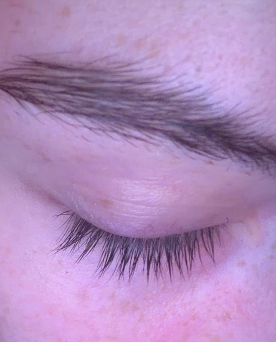 Customer photo review of Eyelash Growth Serum