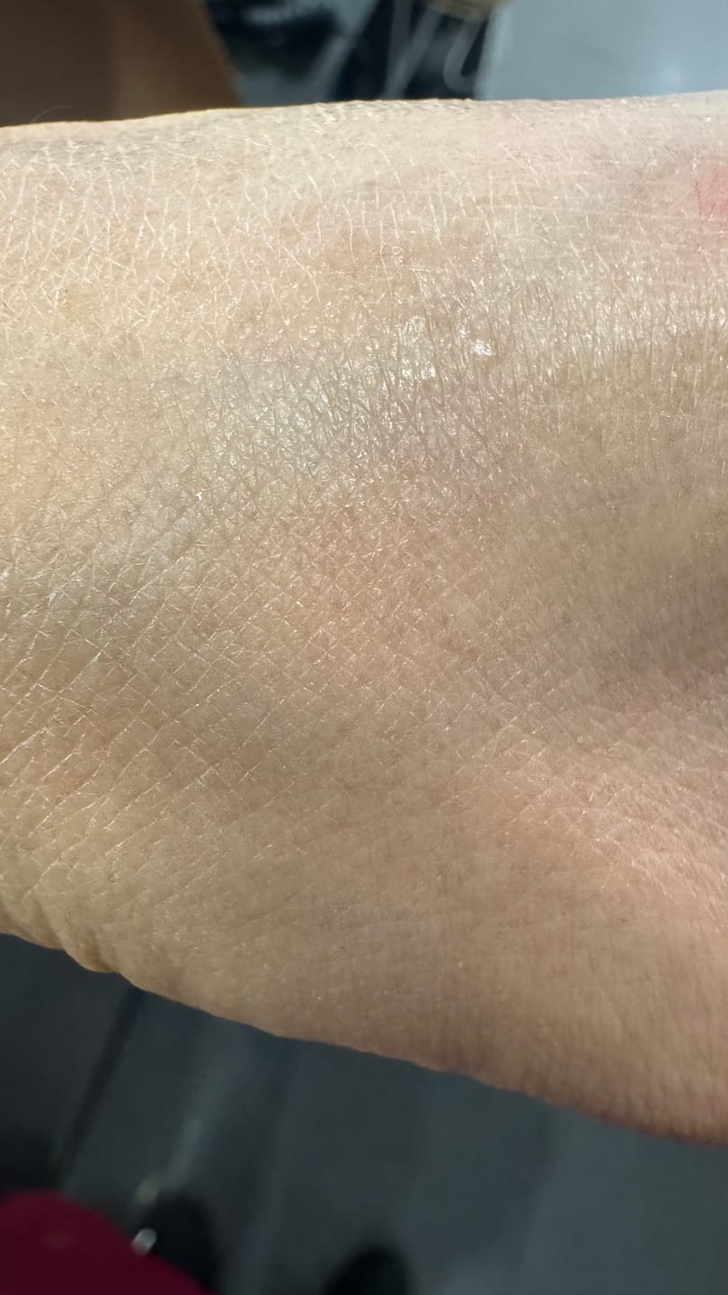 Customer photo review of Hemp Seed Rescue Butter