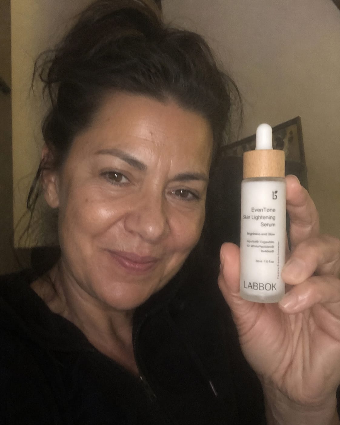 Customer photo review of Labbok EvenTone Peptides Lightening Serum