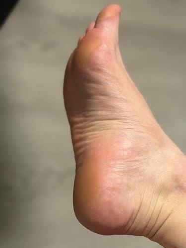 Customer photo review of Valanea SilkSmooth Pro™ Electric Foot Callus Remover