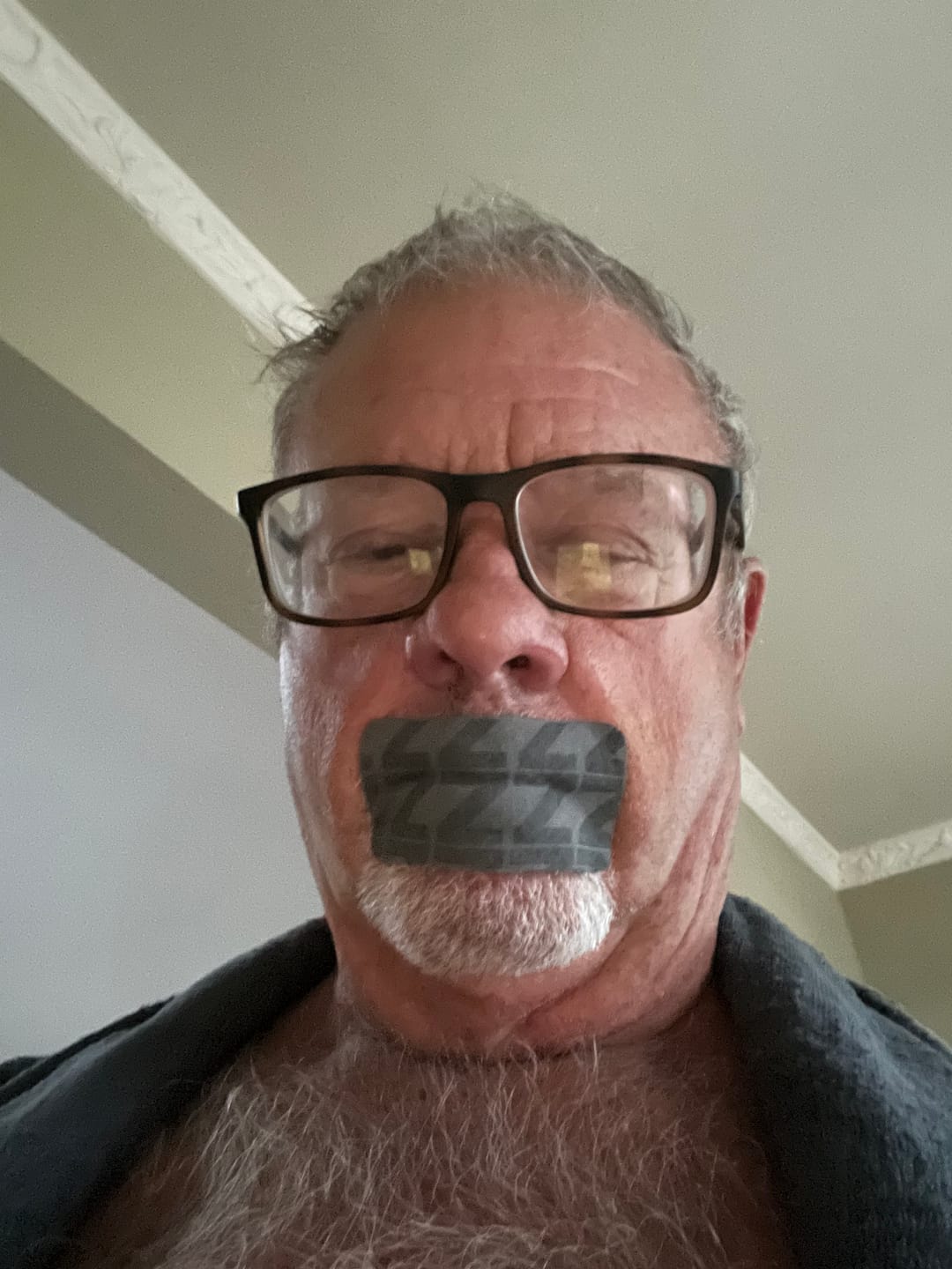 Customer photo review of ZzzTape - Mouth Tape