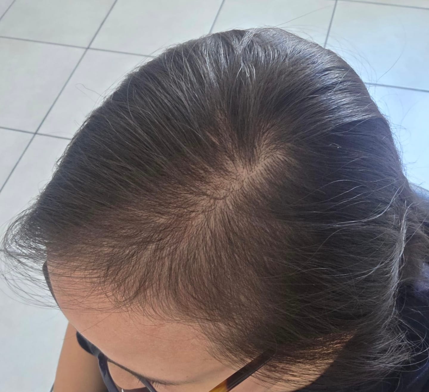 Customer photo review of Castor Oil Shampoo Bar – Brittle & Dry Hair | VIORI
