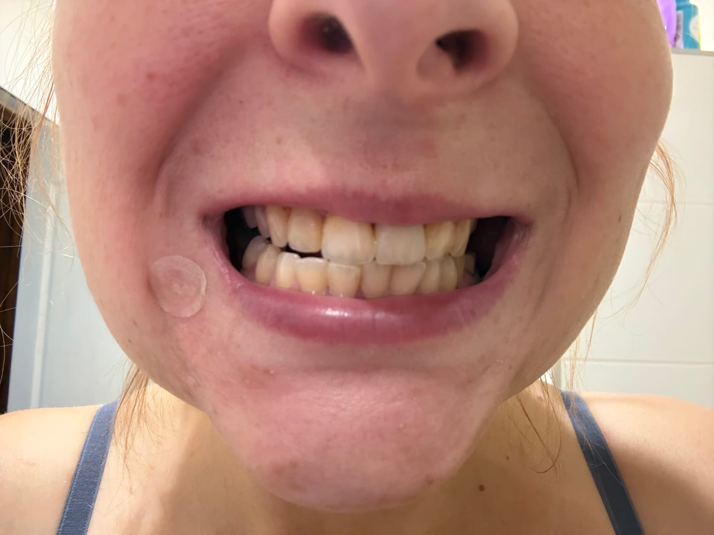 Customer photo review of Mentolová bieliaca zubná pasta bez fluoridu LYSS