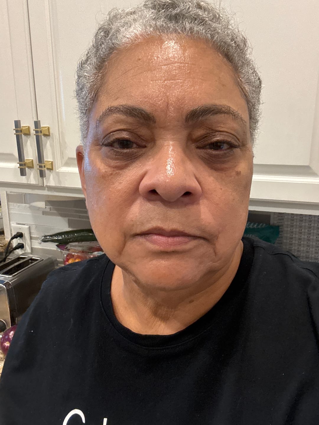 Customer photo review of 5x Vitamin C Morning Glow Serum