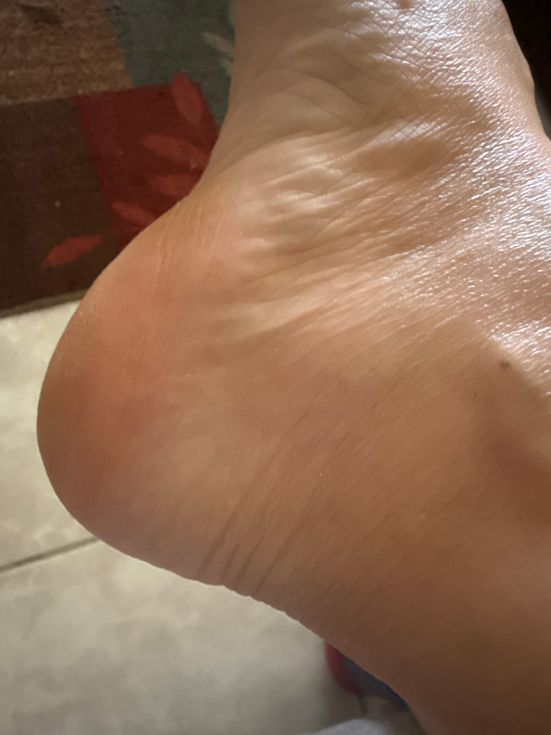 Customer photo review of Foot Balm