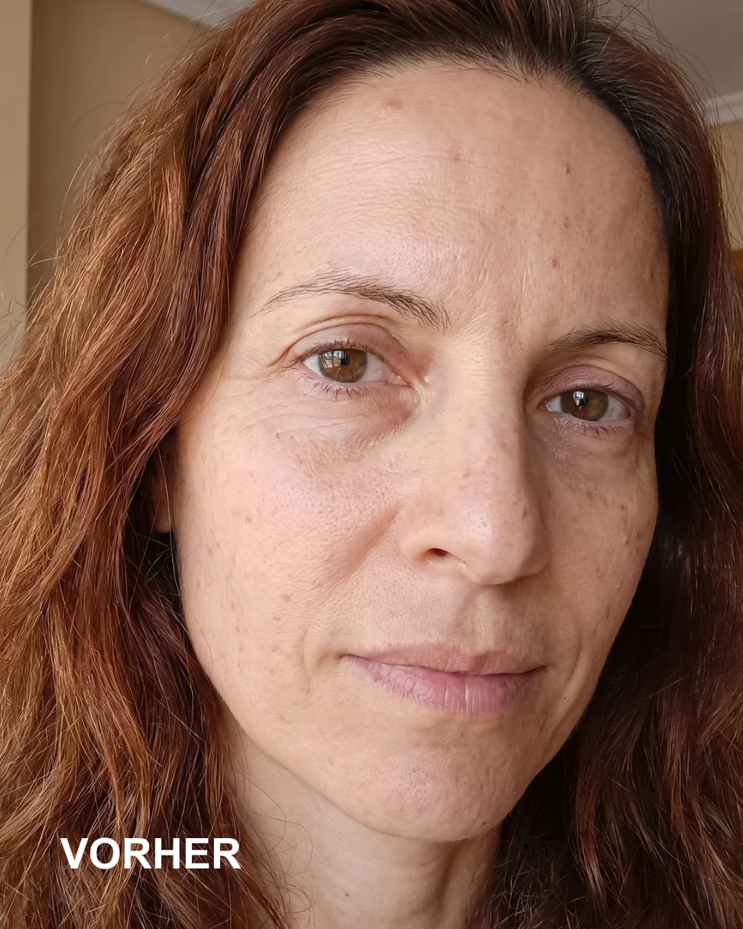 Customer photo review of LUMIN BOOST™ Peptide Creme