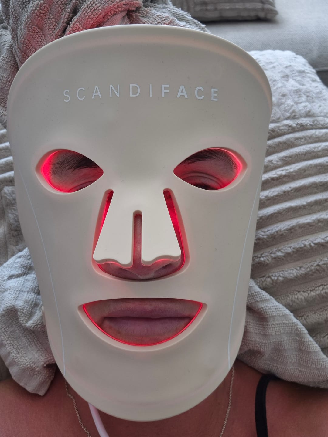 Customer photo review of Skinboosting LED mask