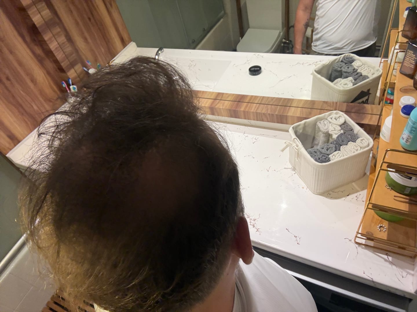 Customer photo review of Flxhair Saç tozu