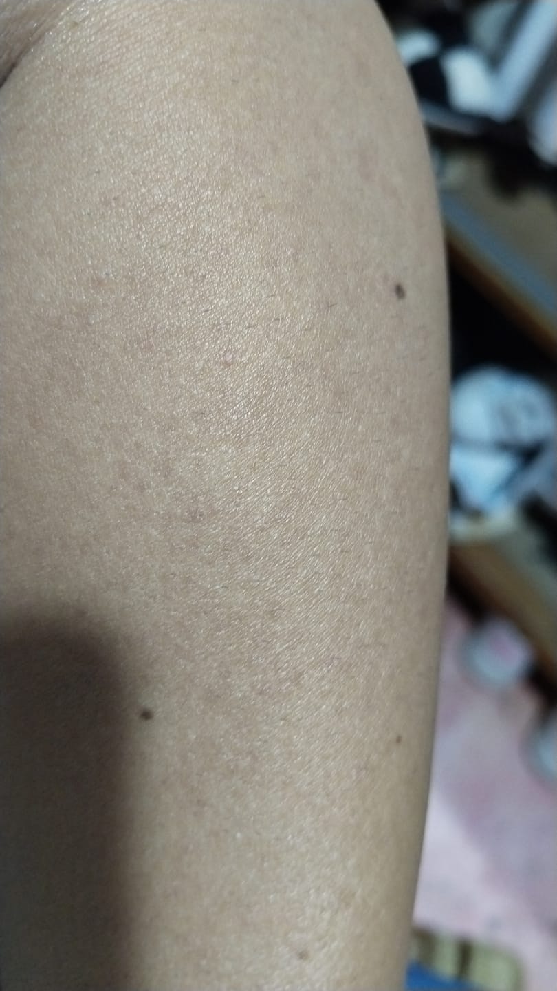 Customer photo review of SkinUp Clásica