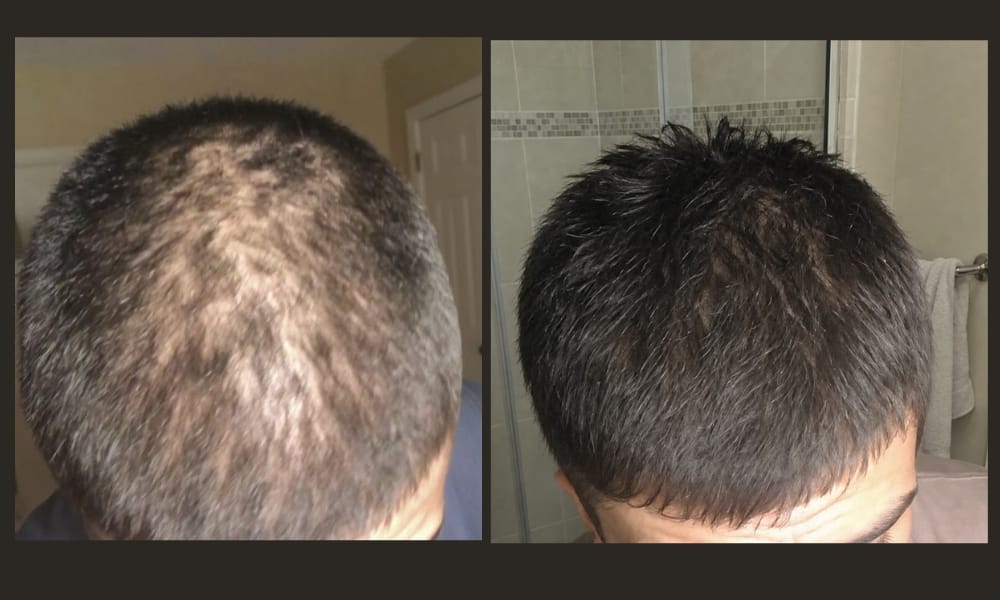 Customer photo review of STRENOVA FUNDAMENTAL BUNDLE