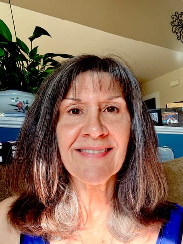 Reviewer's skin after using the Seranova Micro Infusion System, showing smoother texture and reduced lines.
