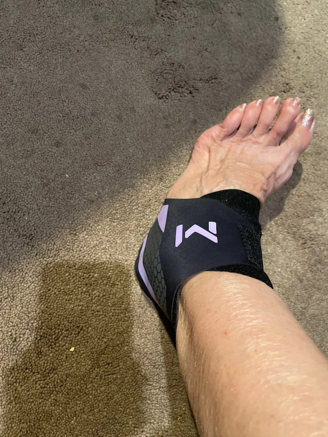 Customer photo review of Restora Plantar Fasciitis Relief Wrap