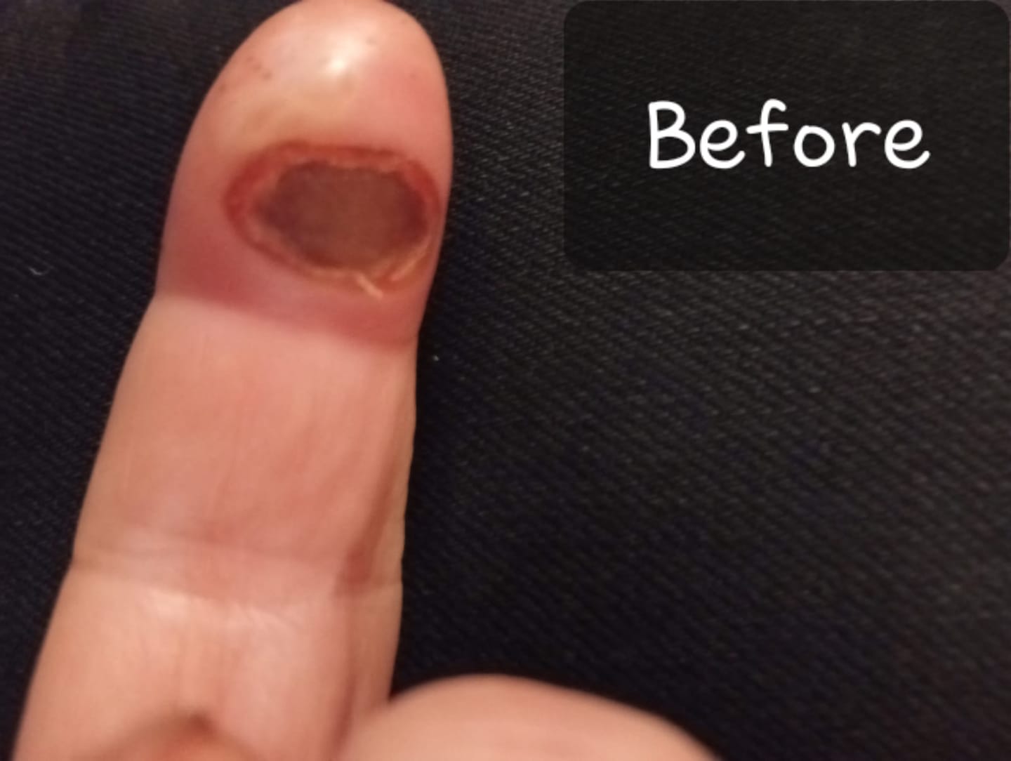 Customer photo review of Crescel Skin Renewal Cream - 3.4 oz
