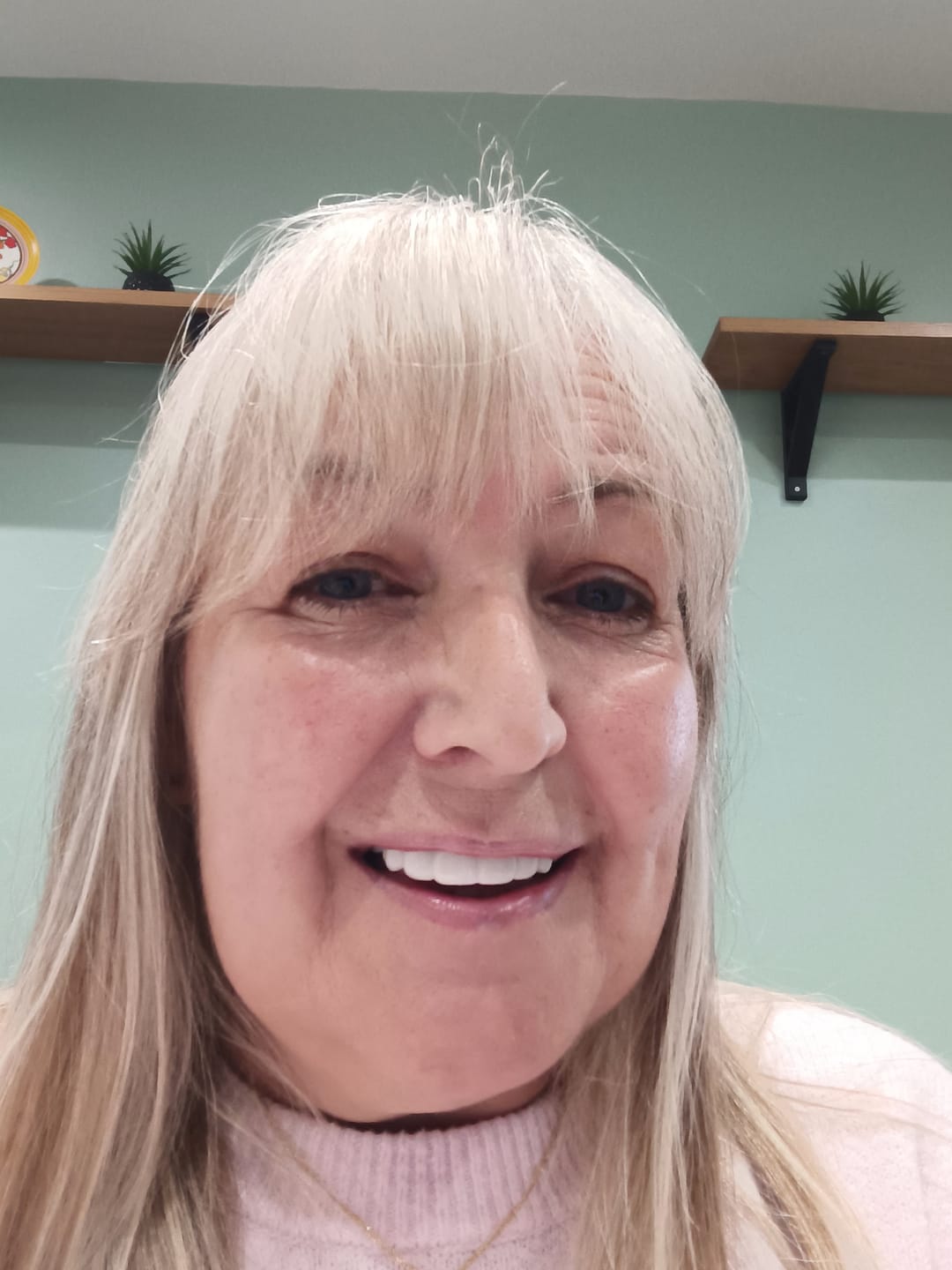 Customer photo review of Click-in Veneers 4.0
