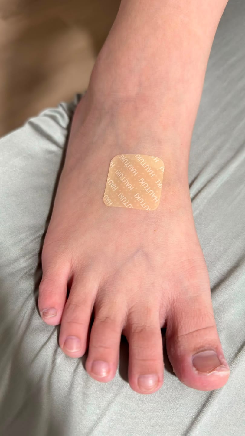 Customer photo review of HAUTUKI Wellness Patch