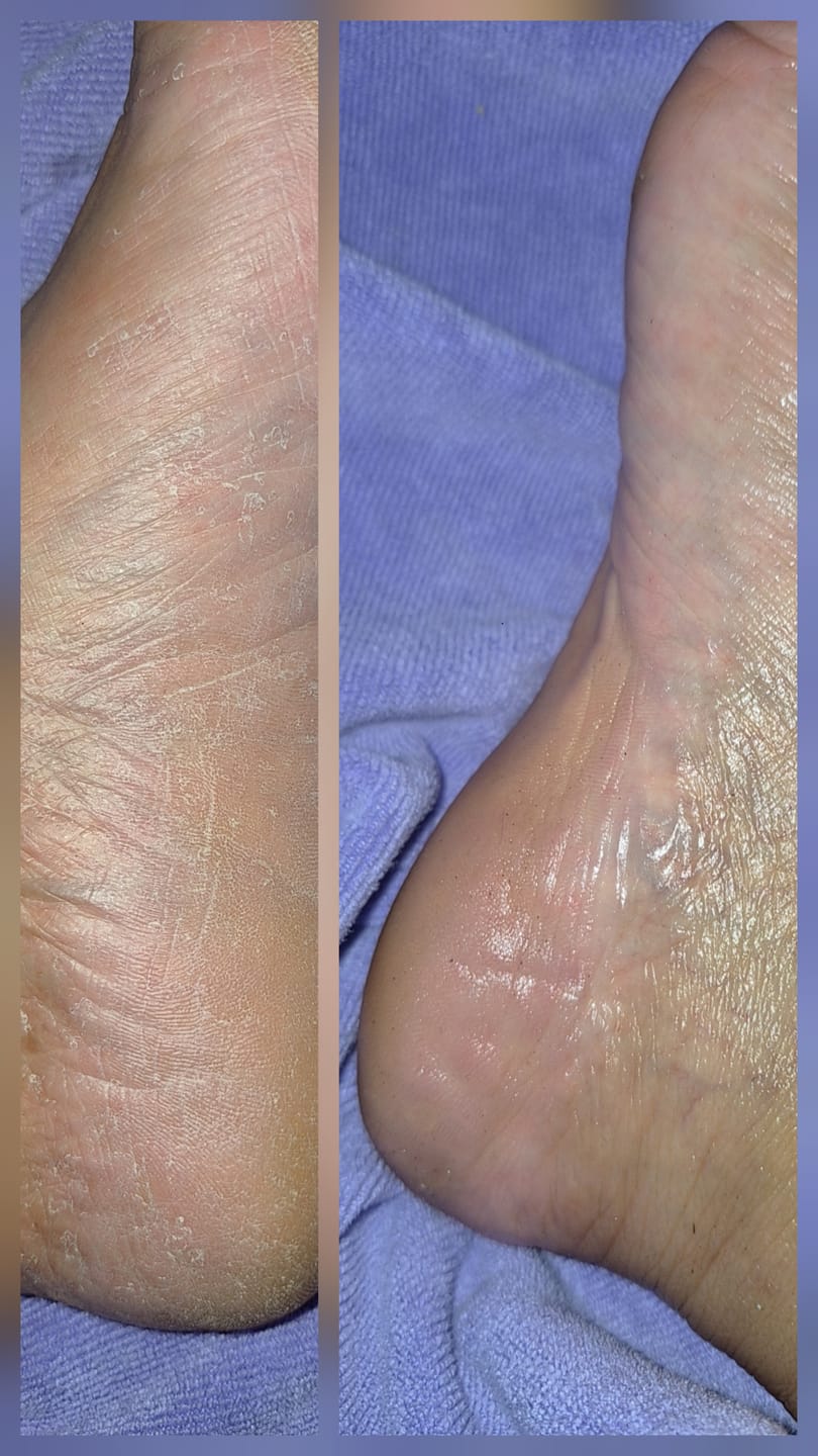 Customer photo review of Foot Balm
